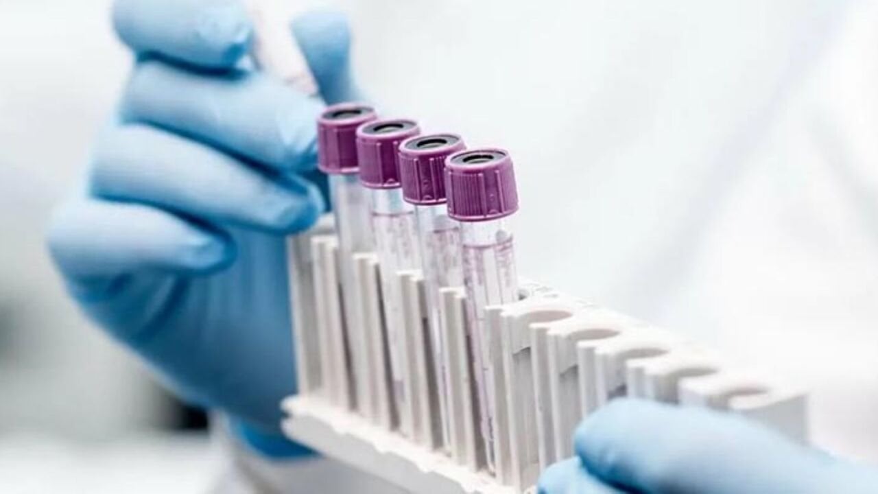 ALT: Nedir, Yüksekliği, Düşüklüğü ve Tedavisi