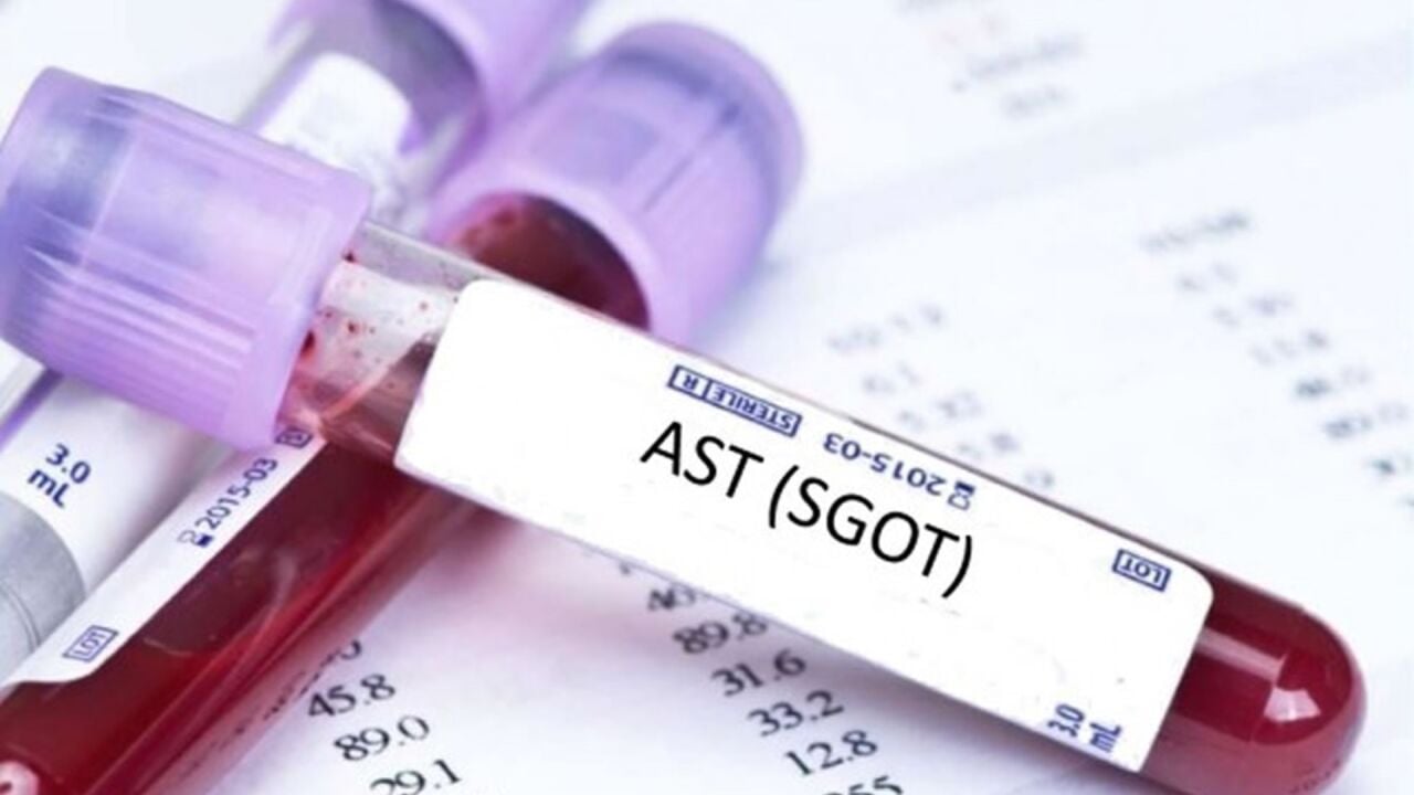 AST: Nedir, Testi ve Yüksekliği