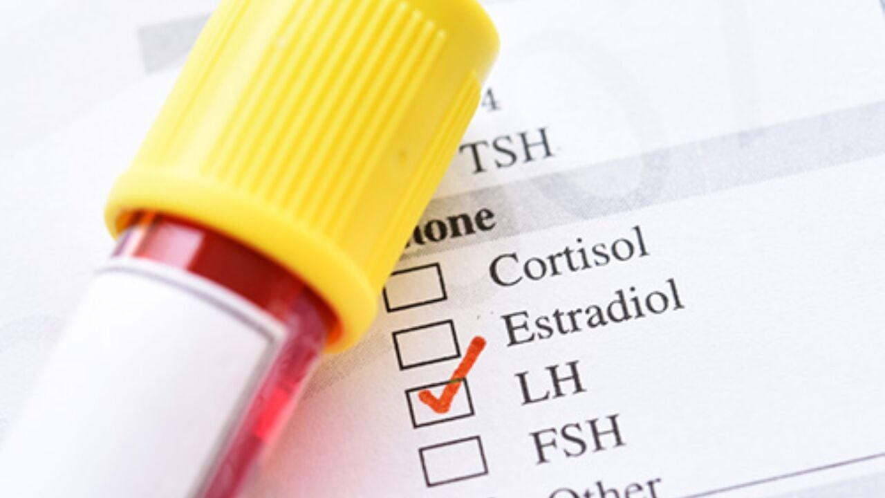 LH Hormonu Ne İşe Yarar? Kaç olmalı, Nasıl Düşürülür?