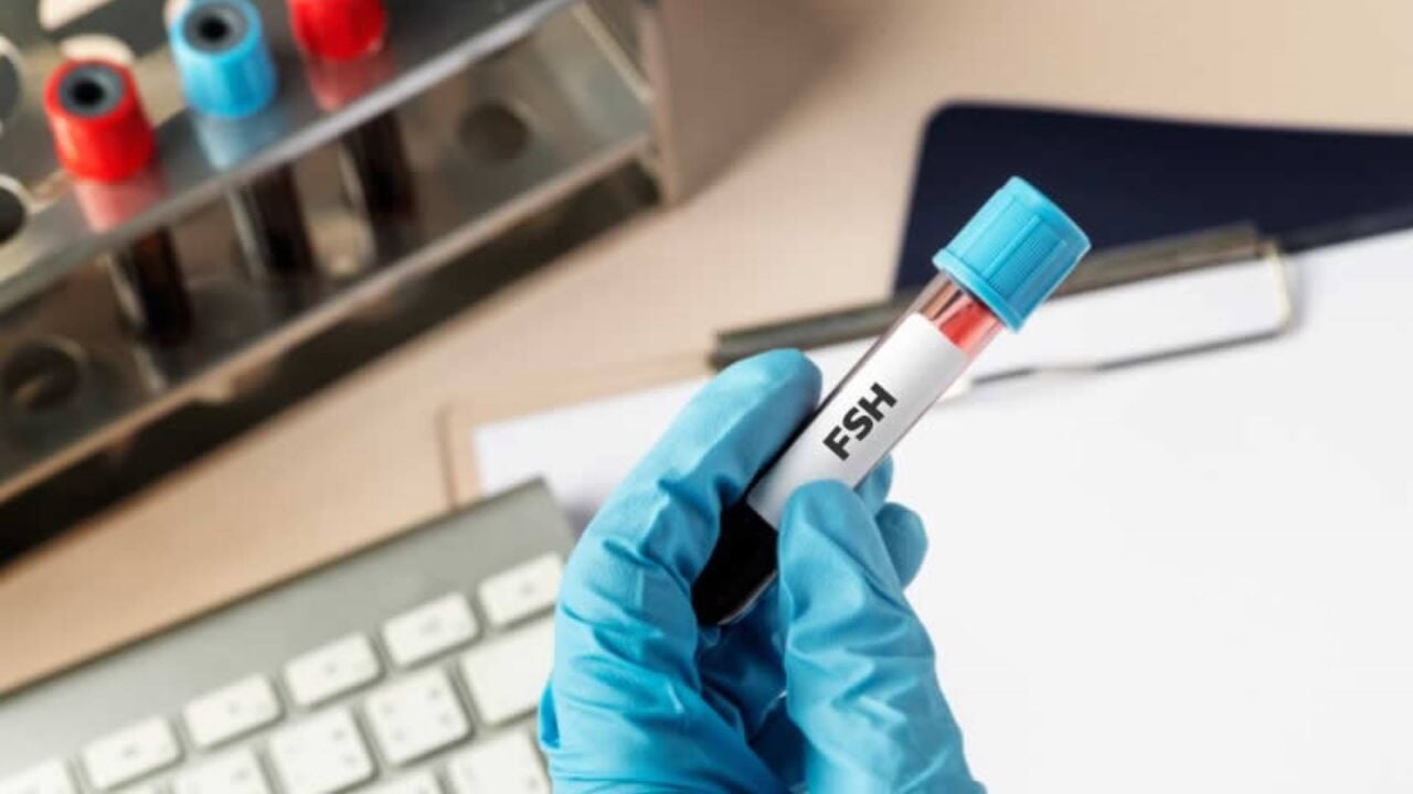 FSH Hormonu Nedir? Kaç Olmalı, Yüksekliği ve Düşüklüğü