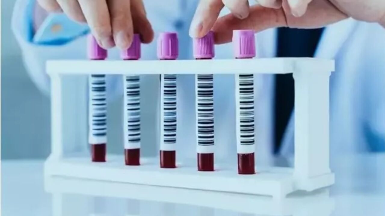 GGT Testi Nedir? Düşüklüğü ve Yükseliği