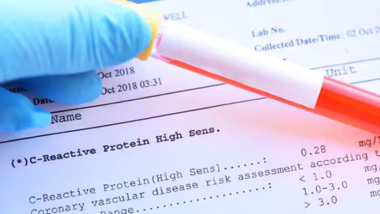 CRP (C Reaktif Protein) Nedir, Neden Yükselir?