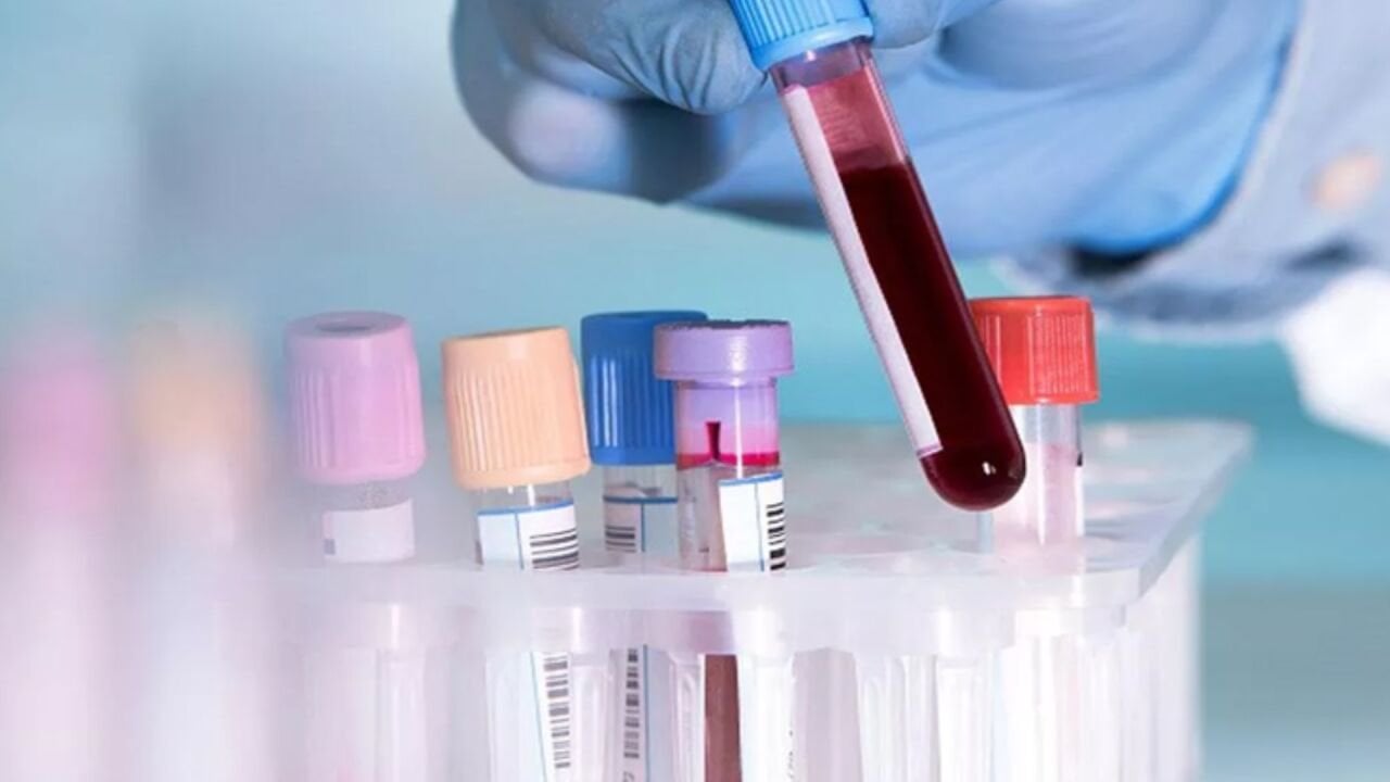 Üre (Bun) Nedir? Üre Düşüklüğü ve Üre Yüksekliği Ne Anlama Gelir?