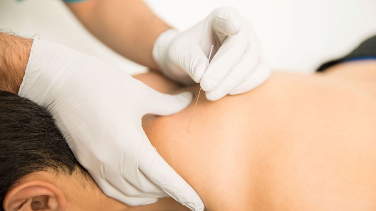 Akupunktur Nedir, Nasıl Yapılır? Akupunktur Noktaları