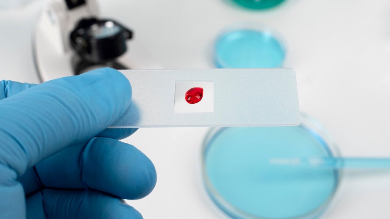 Eritrosit Nedir? Kaç Olmalı? Yüksekliği, Düşüklüğü ve Sağlık Üzerindeki Etkileri