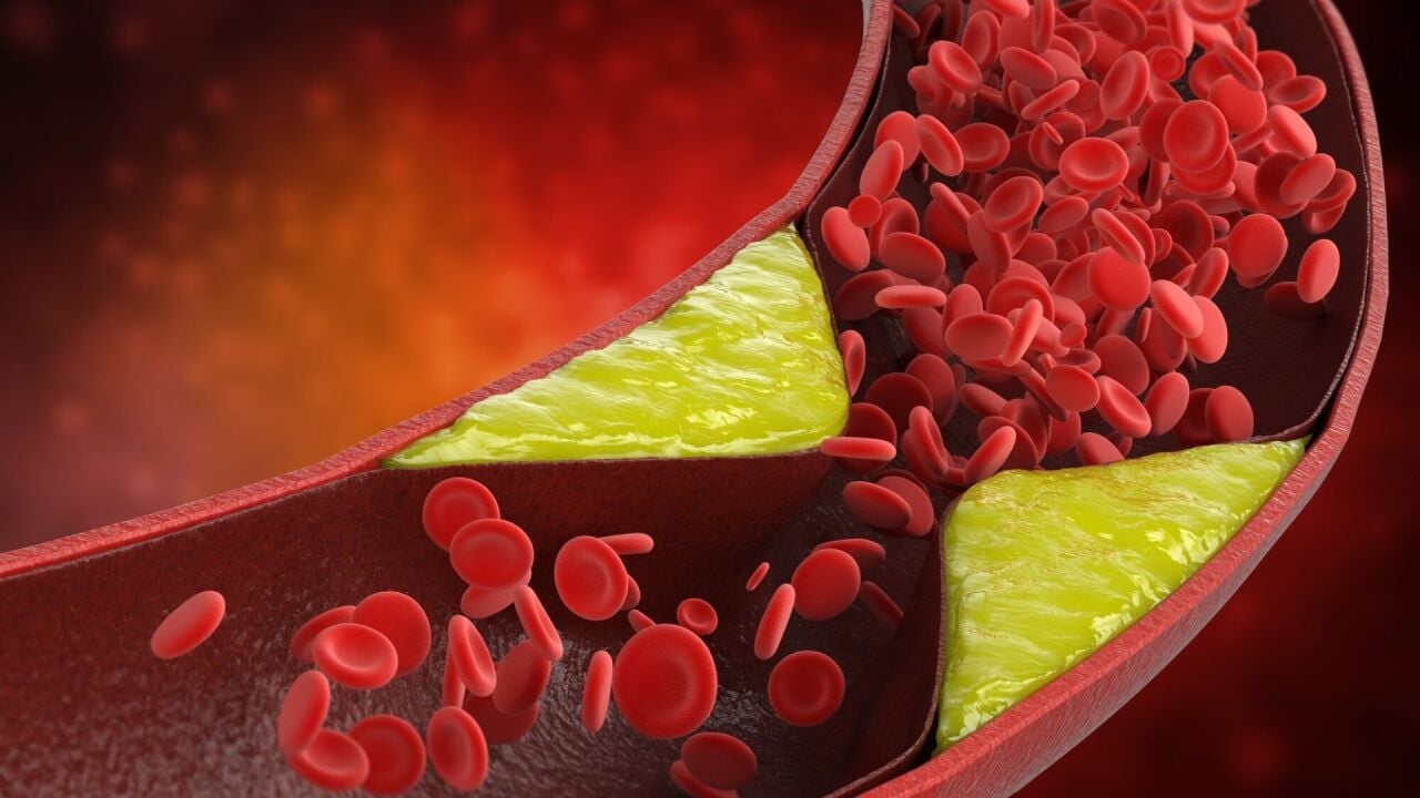 LDL Kolesterol Nedir? Yüksekliği ve Düşüklüğü