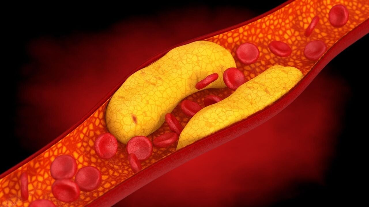 HDL Kolesterol Düşüklüğü Nedir ve Ne Anlama Gelir?